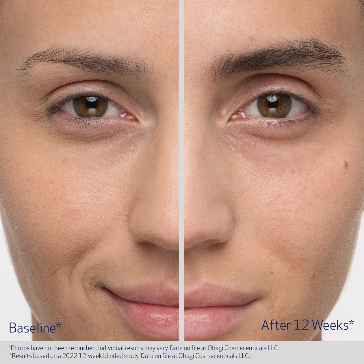 Obagi Nu-Cil Eyebrow Boosting Serum