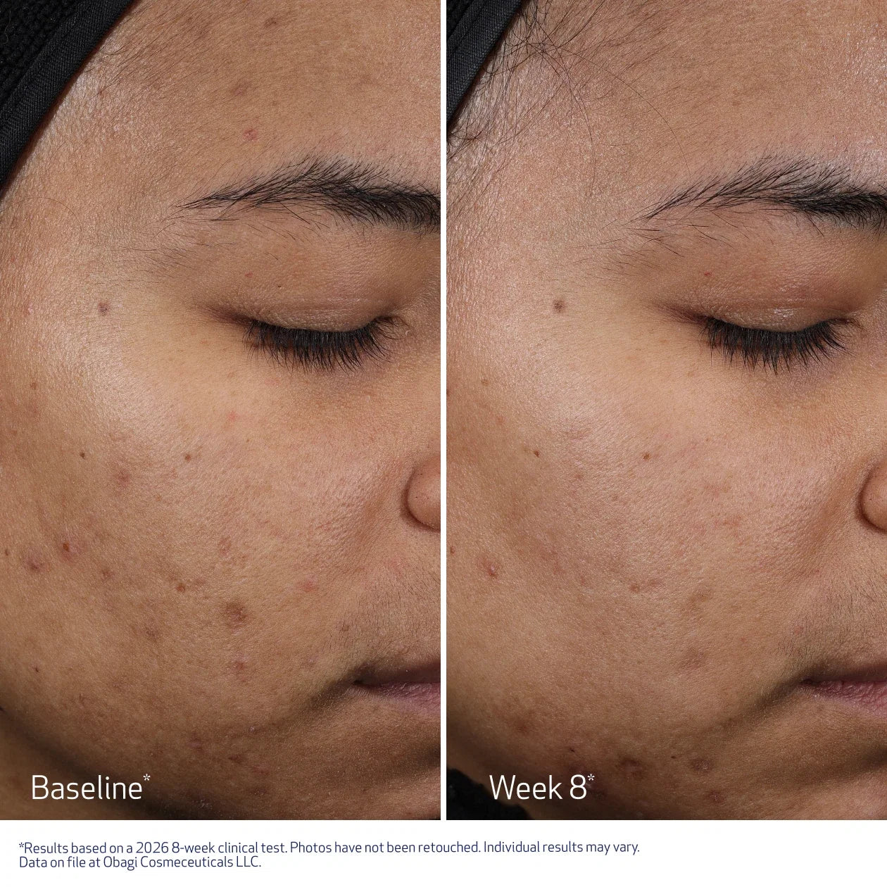 Obagi CLENZIDERM M.D.® Resurfacing Multi-Acid Peel Pads
