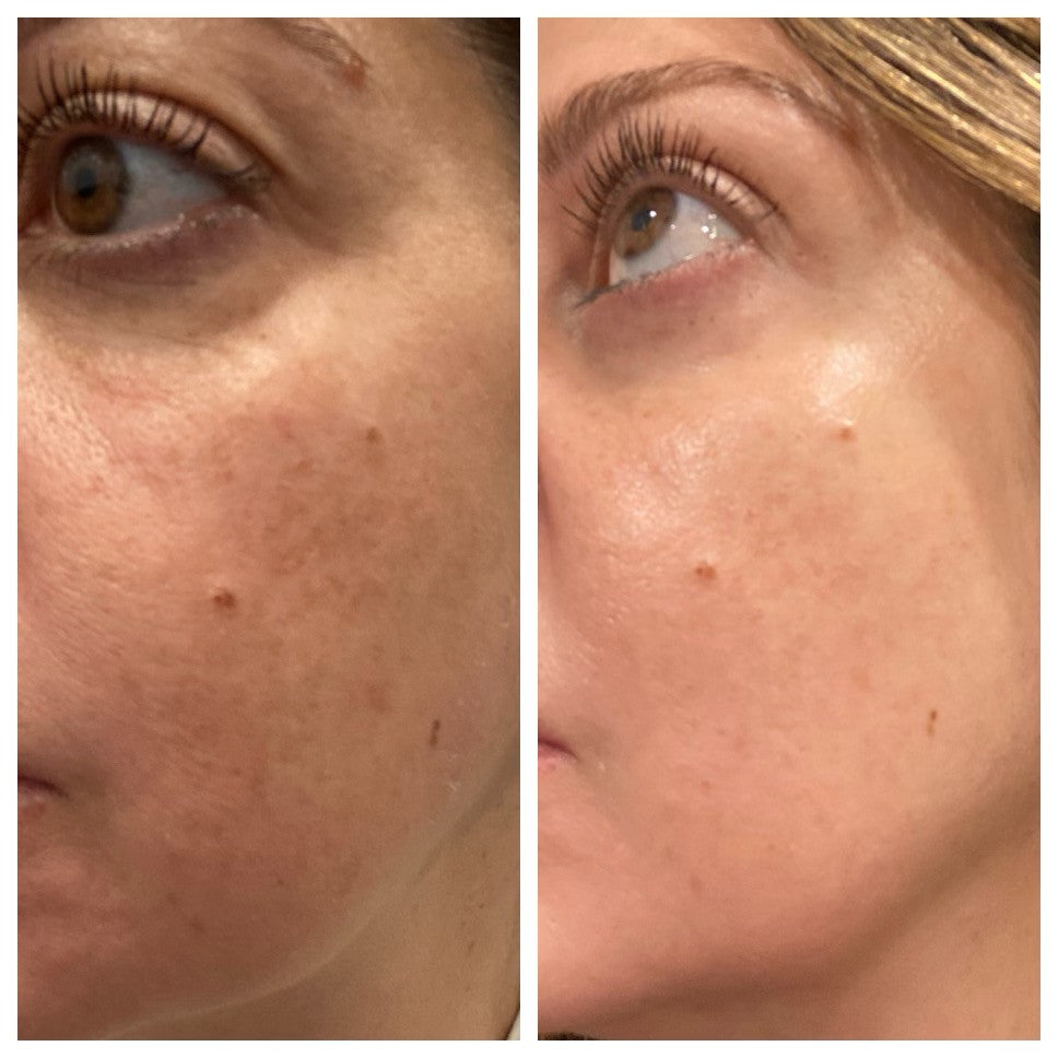 Palm Beach Skincare UV Remedy Skin Care Masks & Peels Palm Beach Skincare