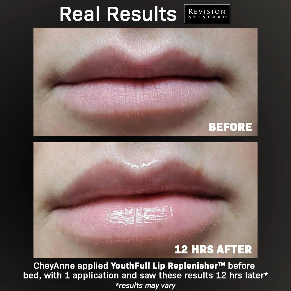 Revision Skincare YouthFull Lip Replenisher