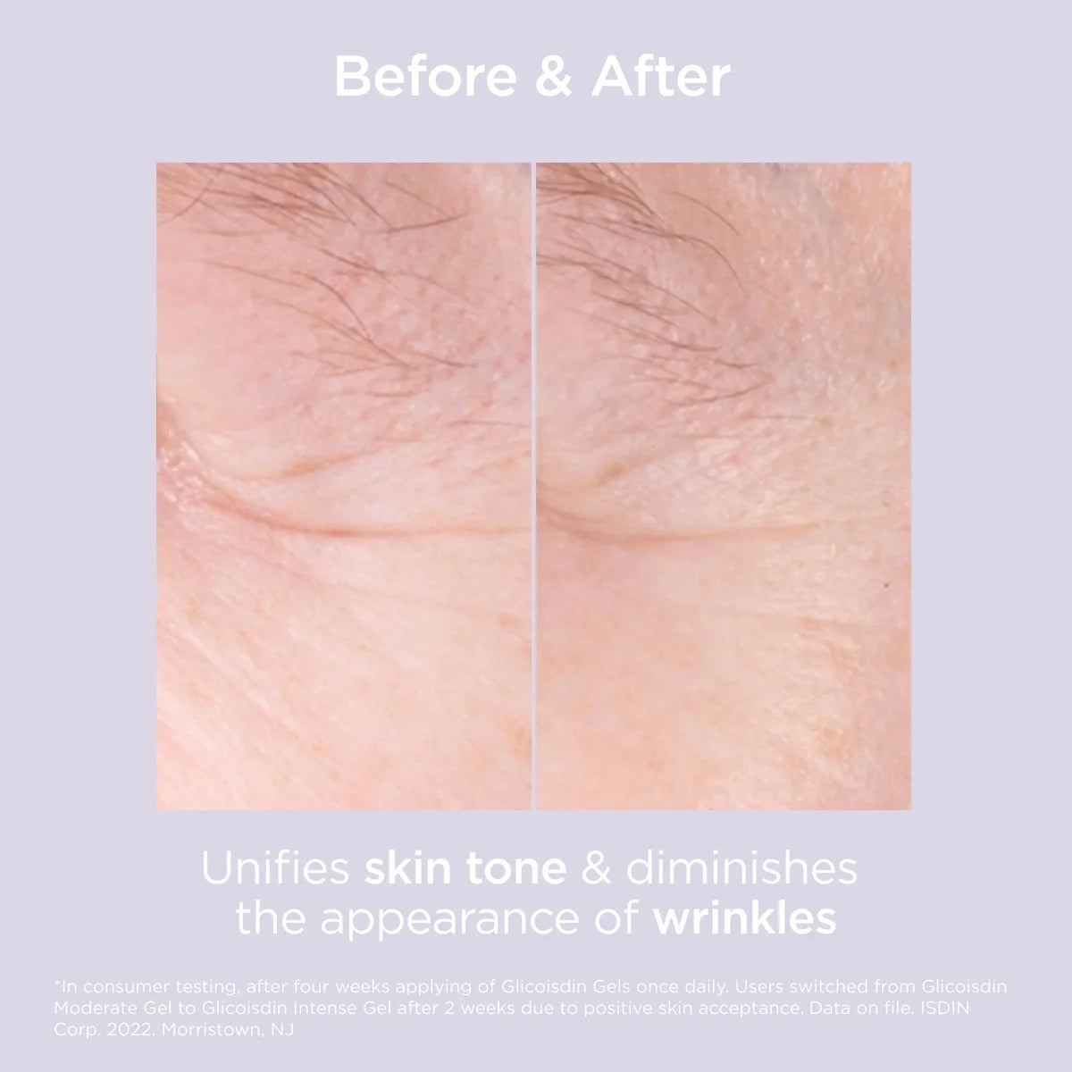 ISDIN Isdinceutics Glicoisdin 15 Moderate Serums & Treatments ISDIN