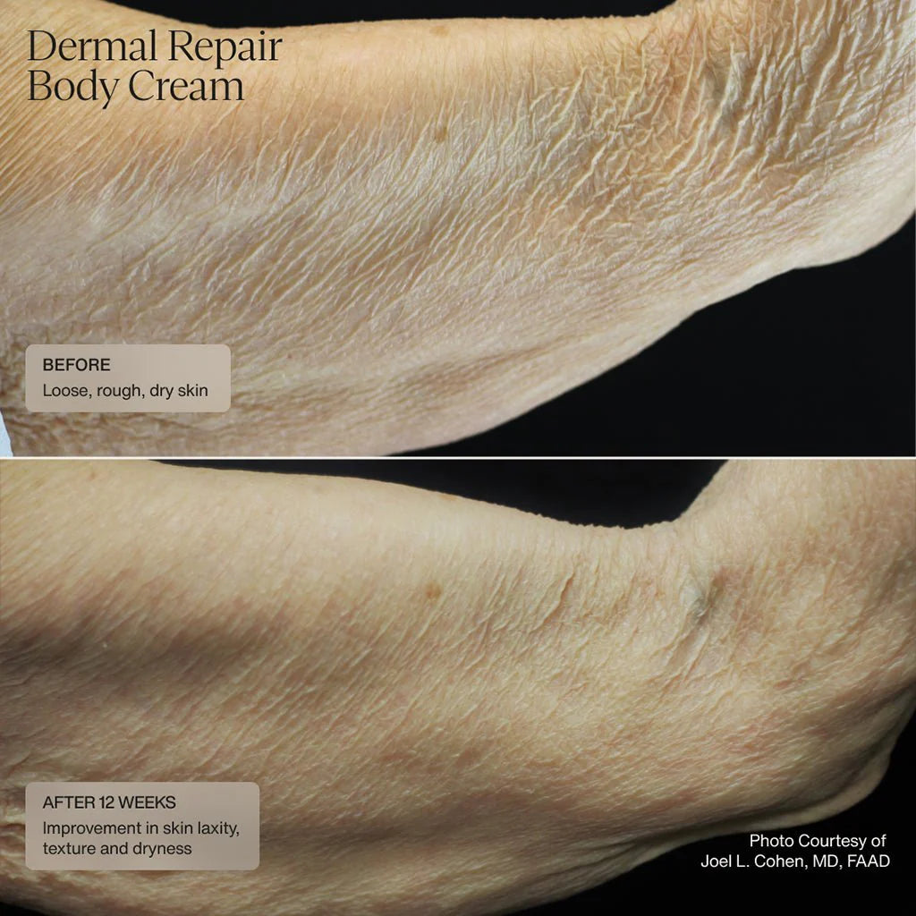 Sente Dermal Repair Body Cream Lotions & Moisturizers Senté