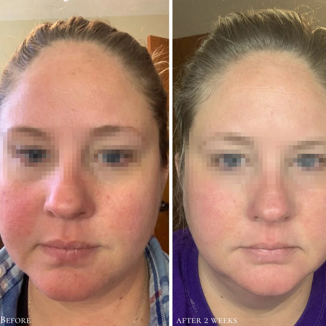 GLOWBIOTICS MD Calming Restorative Treatment