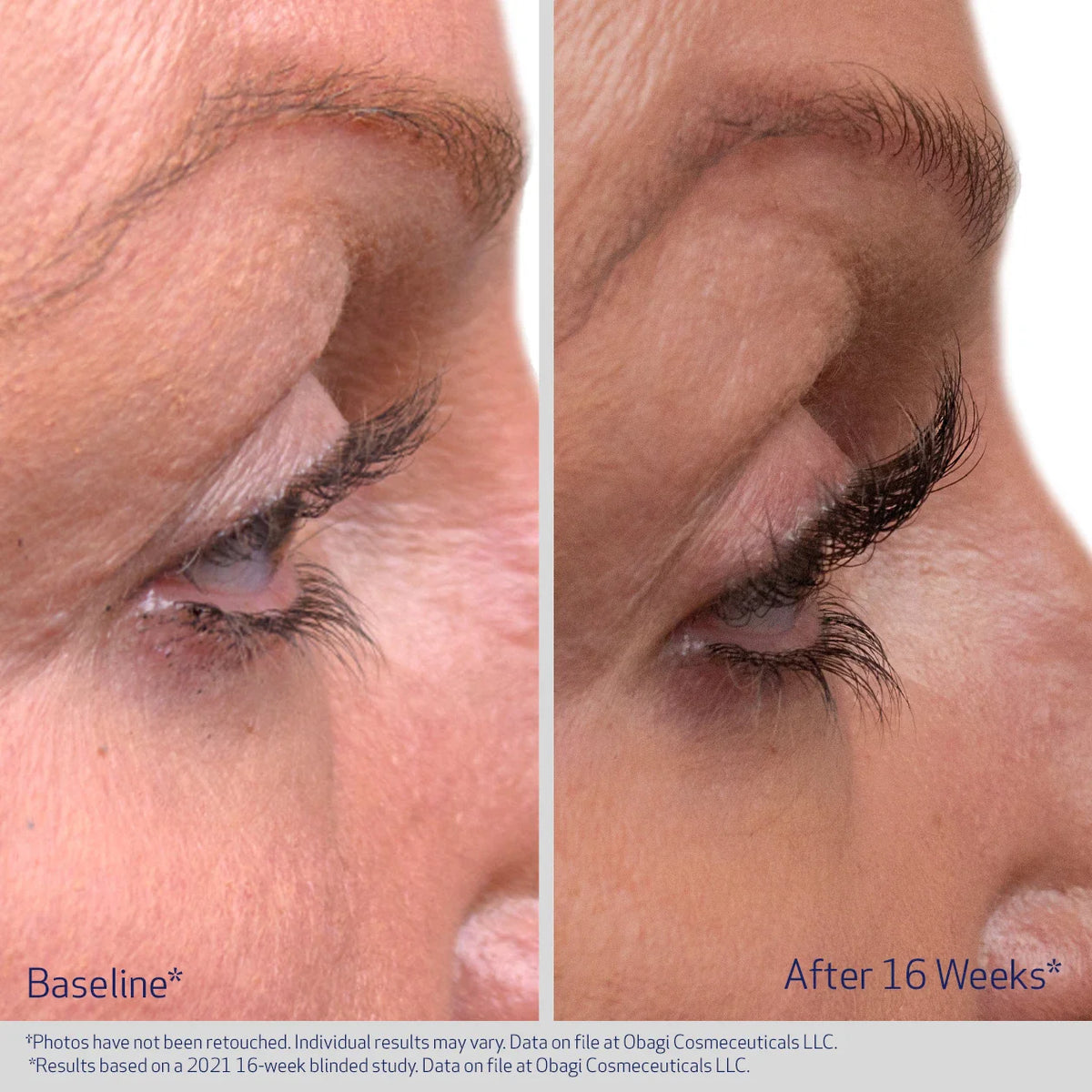 Obagi Nu-Cil Eyelash Enhancing Serum | Skin Truth Obagi Nu-Cil Eyelash Enhancing Serum | Skin Truth