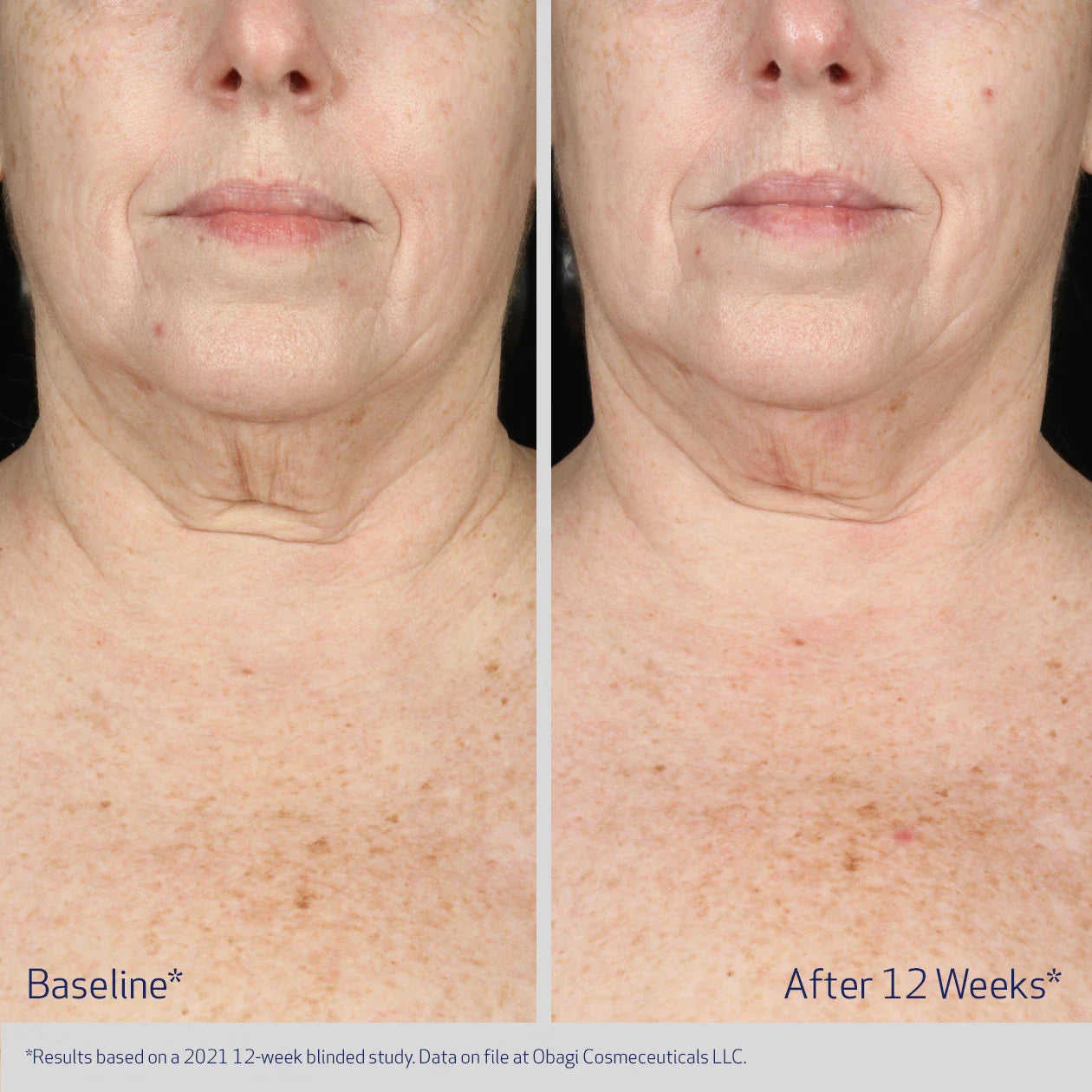Obagi ELASTIderm Neck and Décolleté Concentrate