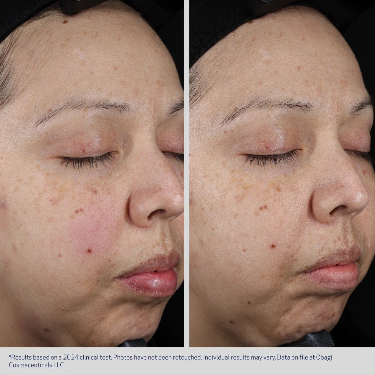 Obagi SUZANOBAGIMD® Moisture Restore