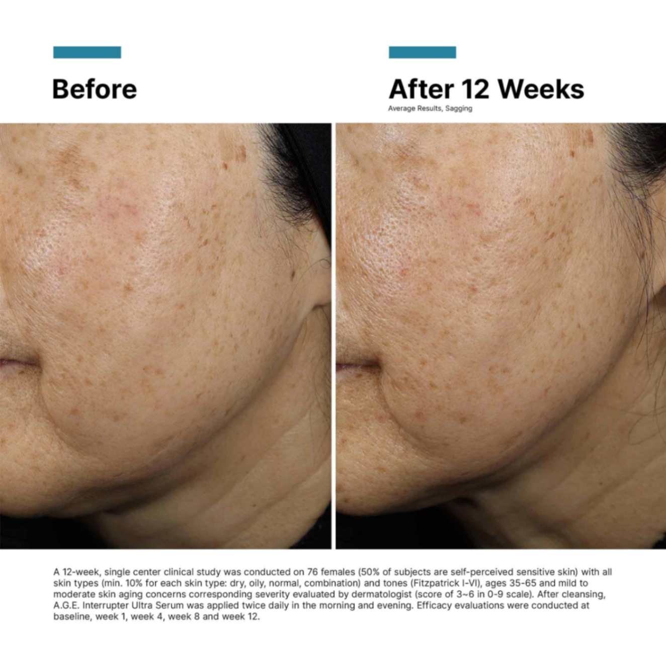 フェイスクリーム SkinCeuticals A.G.E. Interrupter Ultra