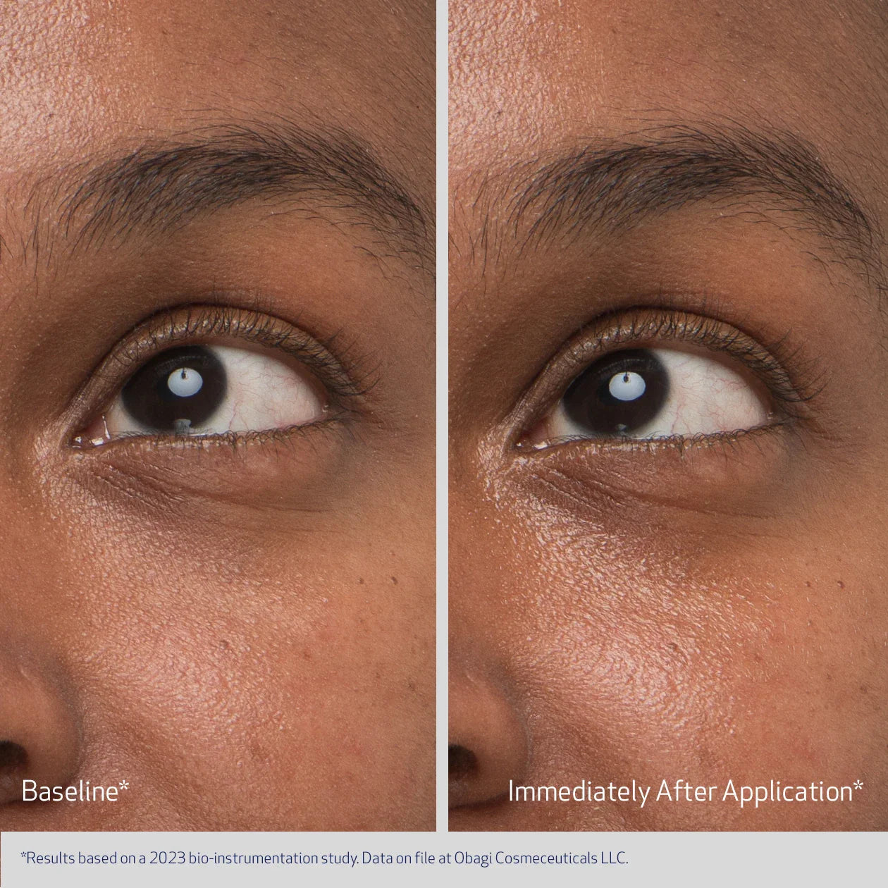 Obagi Daily Hydro-Drops Rejuvenating Eye Gel Cream