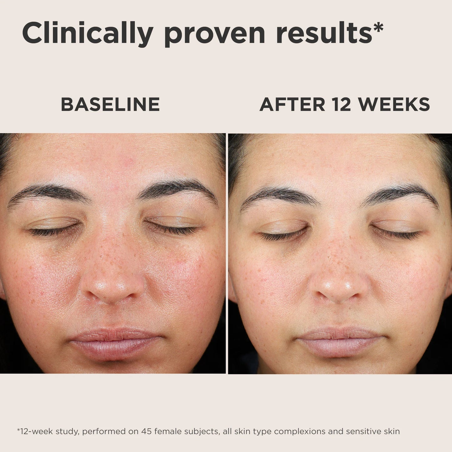 EltaMD UV Skin Recovery Broad Spectrum SPF 50 Face Sunscreen Sunscreen EltaMD
