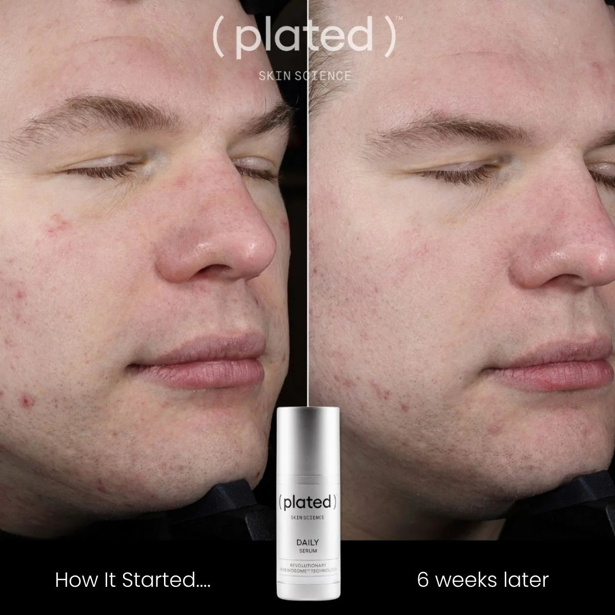 Plated Skin Science DAILY Serum