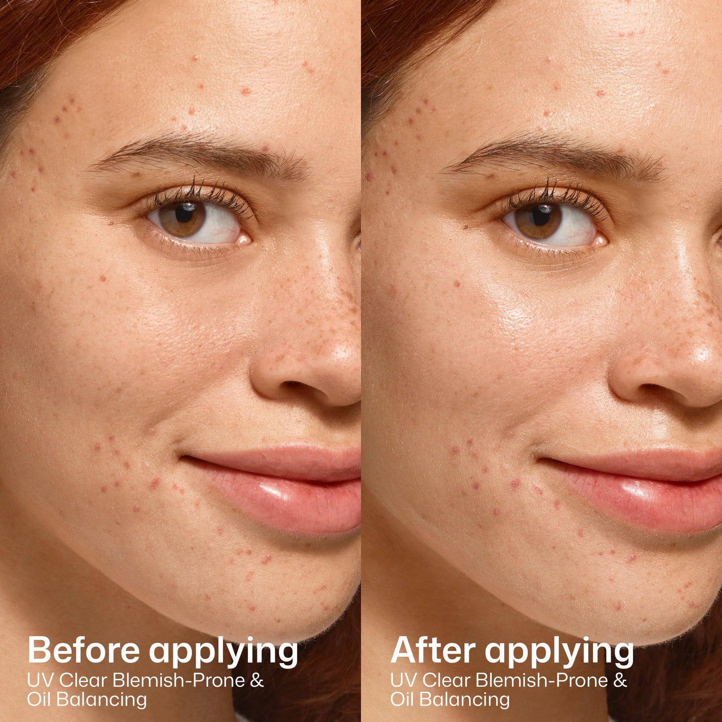 EltaMD UV Clear Blemish-Prone & Oil Balancing SPF 50