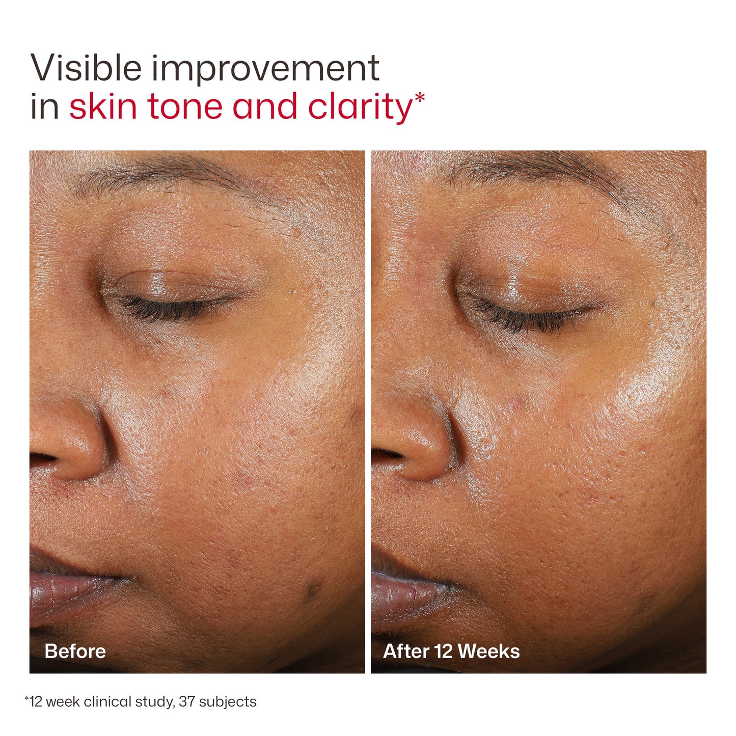EltaMD UV Clear Broad-Spectrum SPF 46 |  Tinted