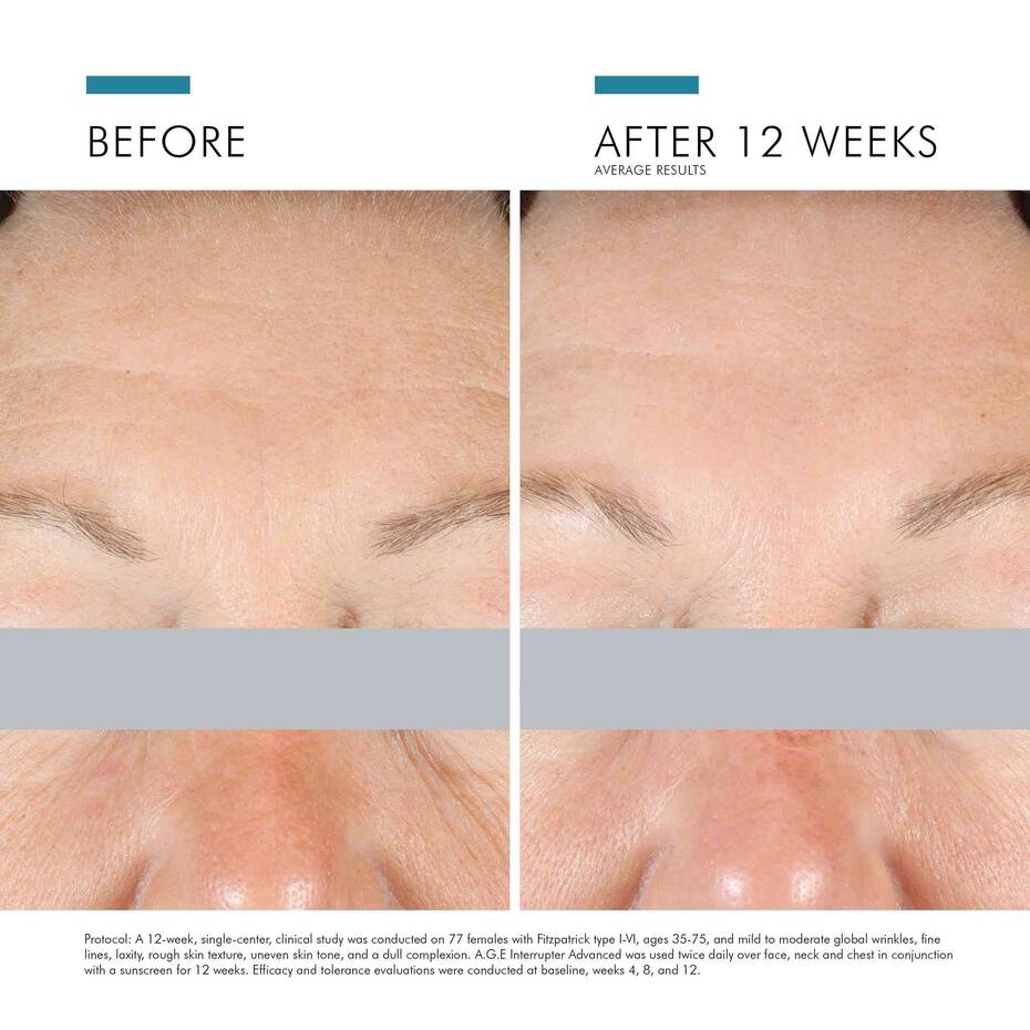 SkinCeuticals A.G.E. Interrupter Advanced | Skin Truth