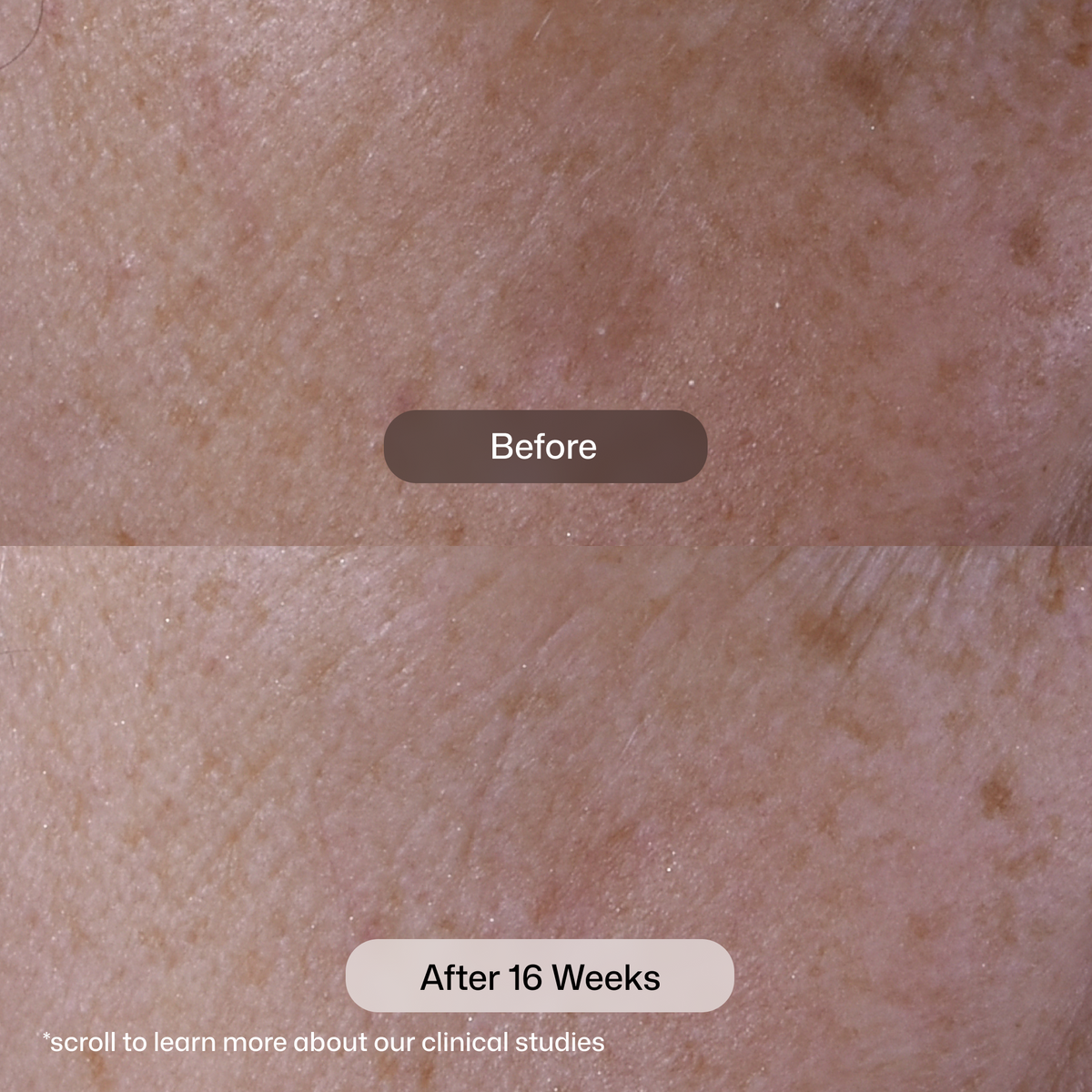 Revision Skincare Advanced Pigment Corrector+