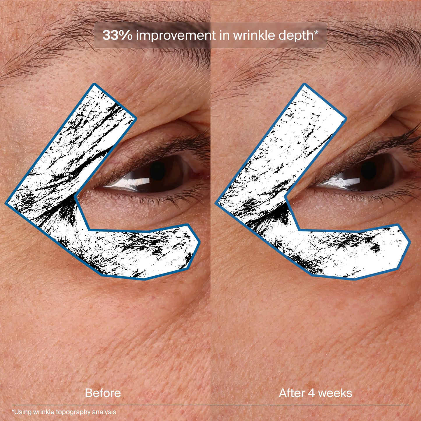 Pavise Bioadaptive Stress Repair