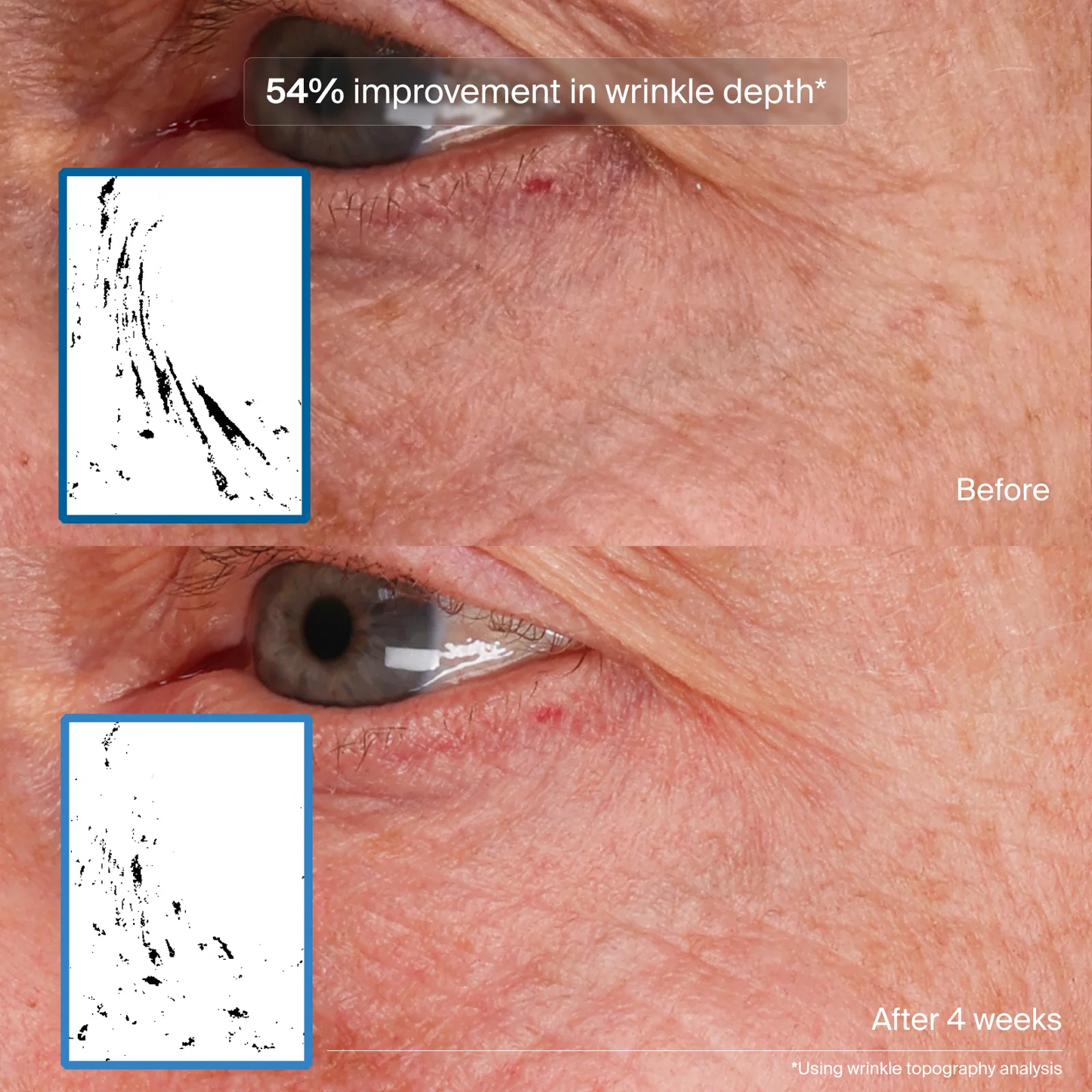 Pavise Bioadaptive Stress Repair