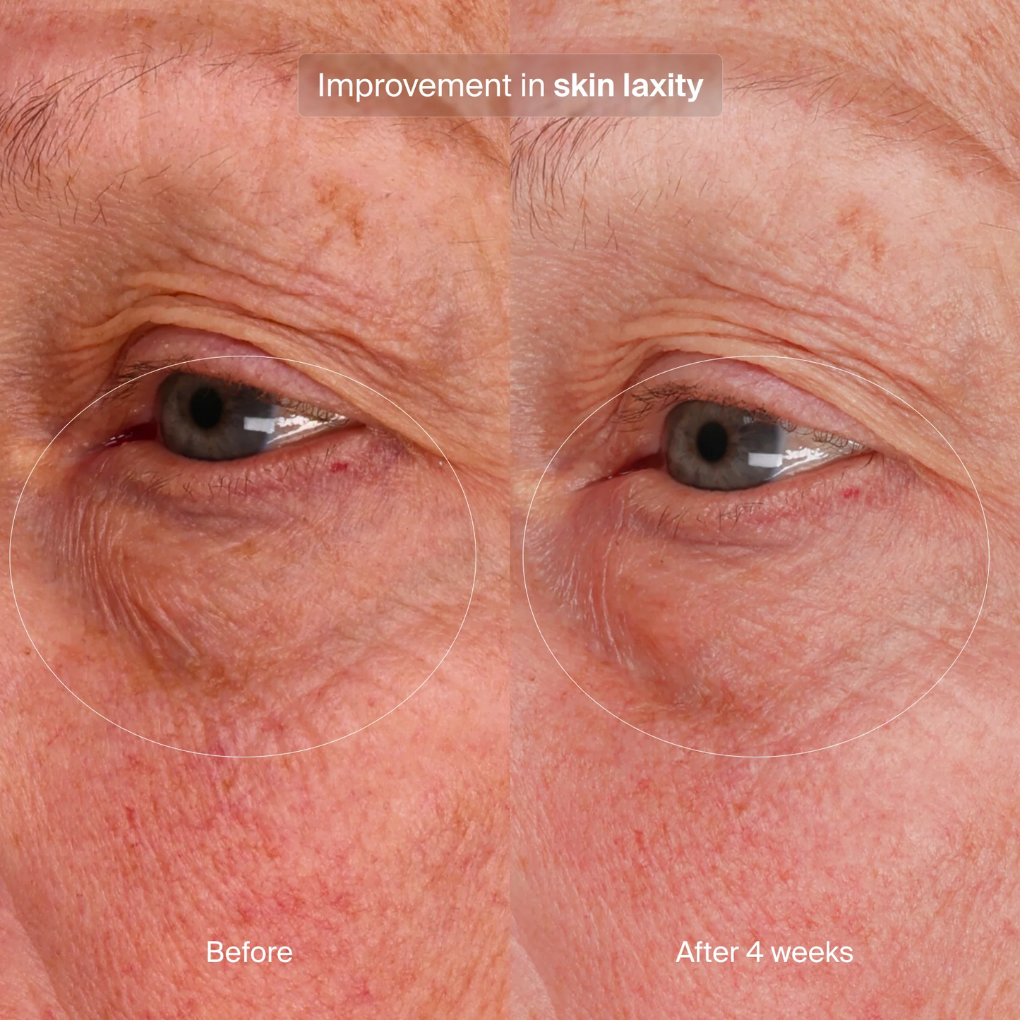 Pavise Bioadaptive Stress Repair