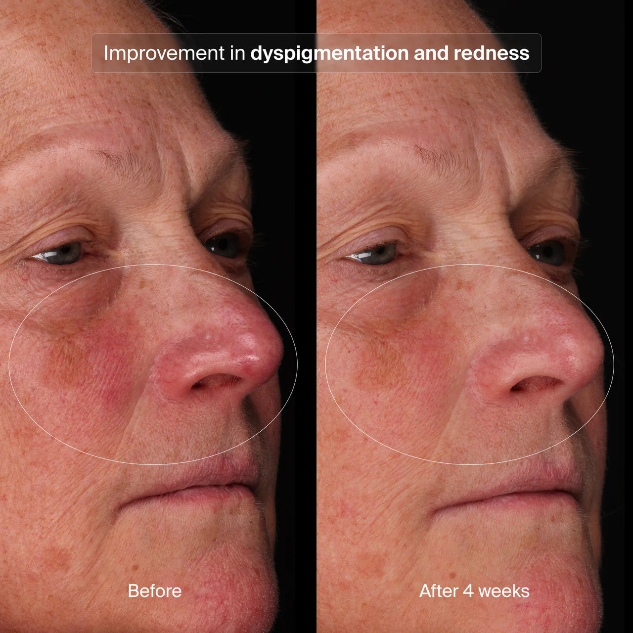 Pavise Bioadaptive Stress Repair Serums & Treatments Pavise