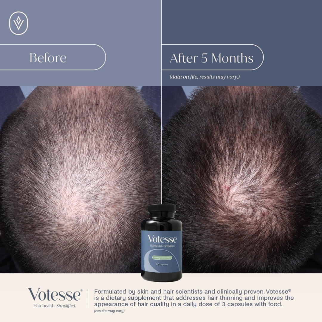 Votesse Hair Health Dietary Supplement