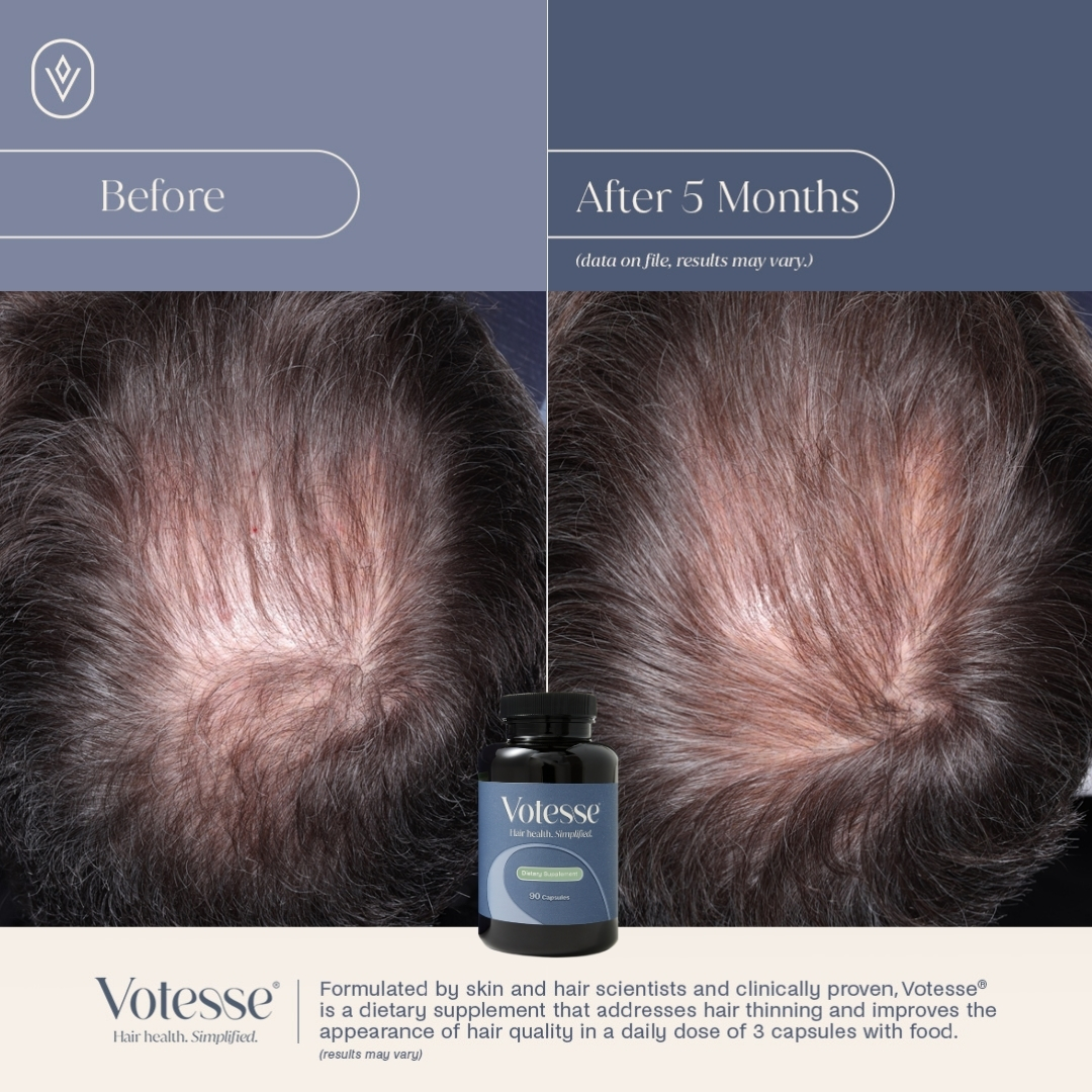 Votesse Hair Health Dietary Supplement