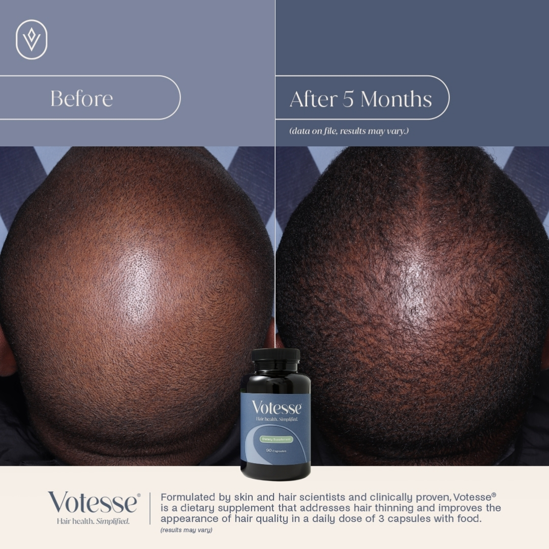 Votesse Hair Health Dietary Supplement