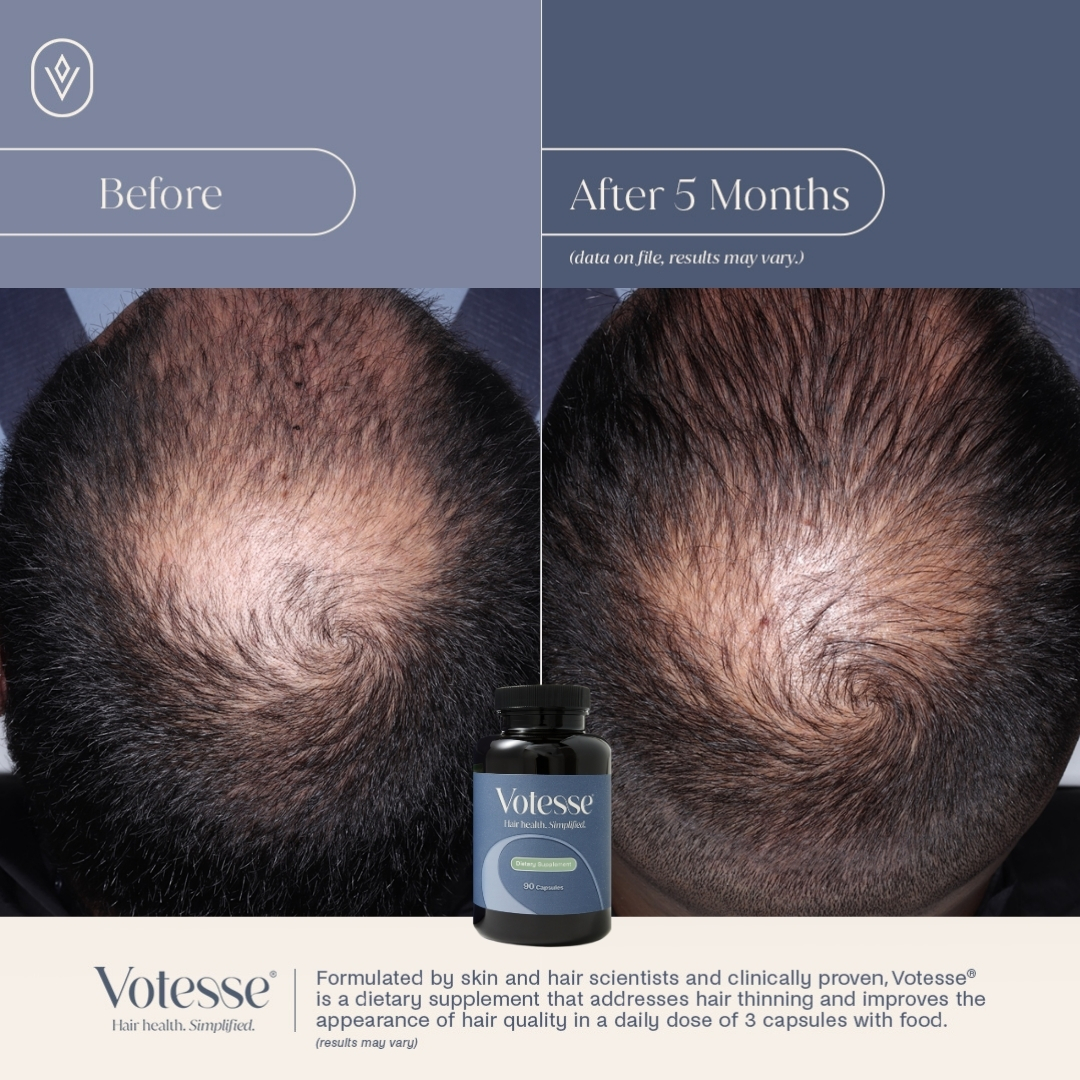 Votesse Hair Health Dietary Supplement