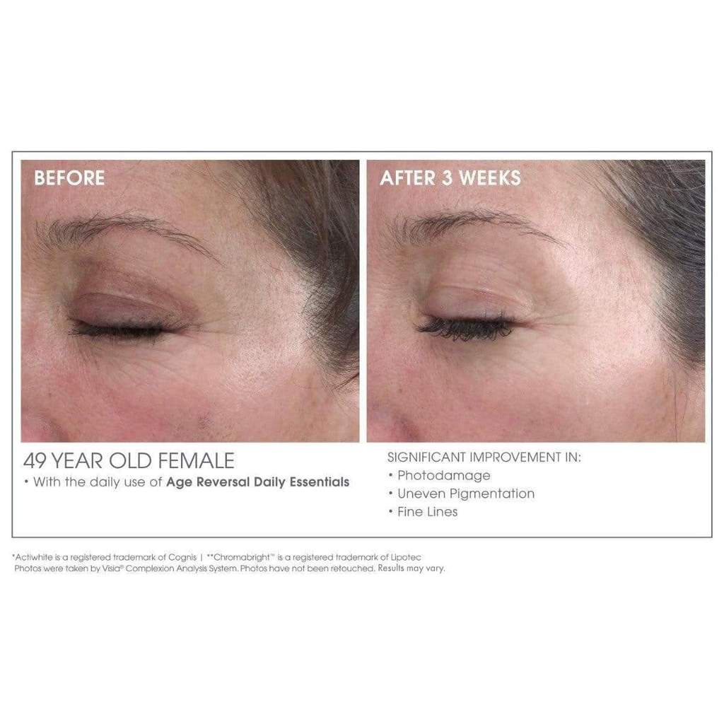 GLOWBIOTICS MD Advanced Retinol Renewal Treatment