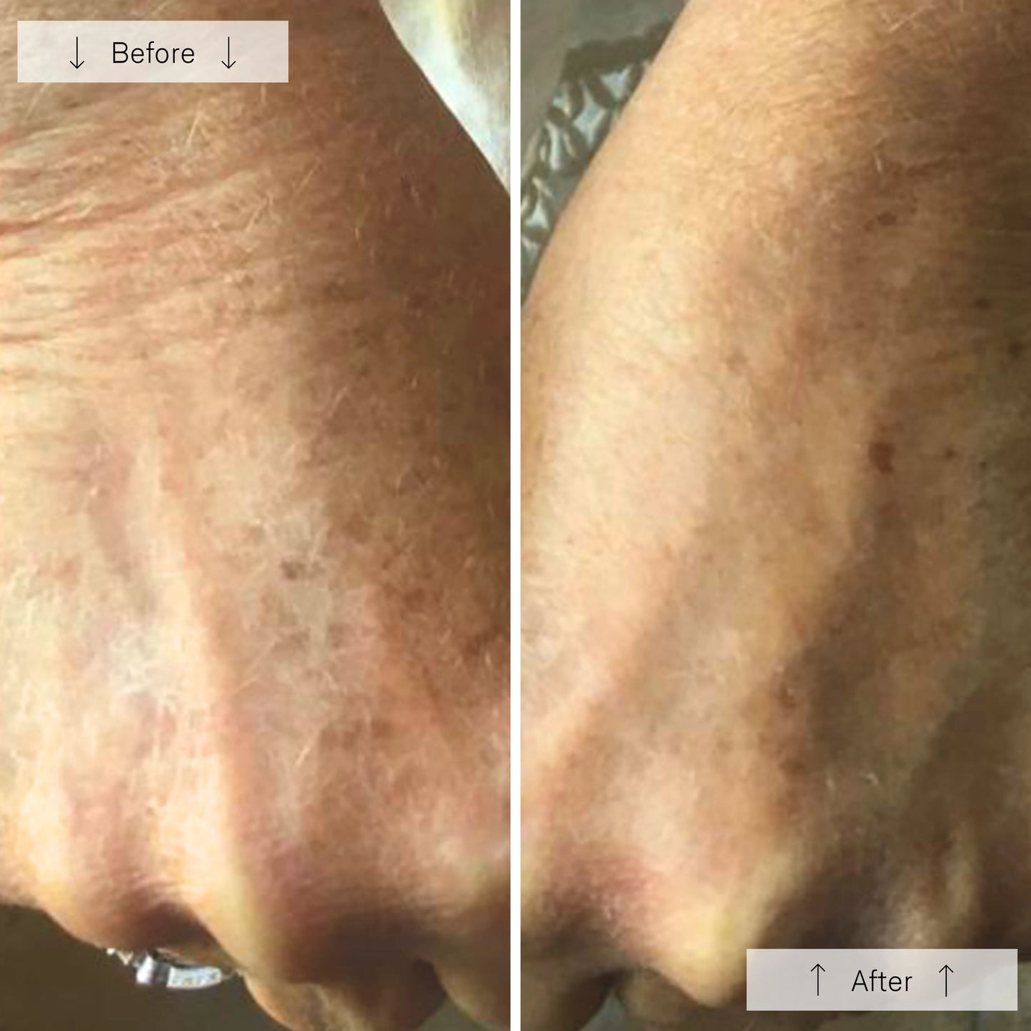 Omnilux Contour Glove