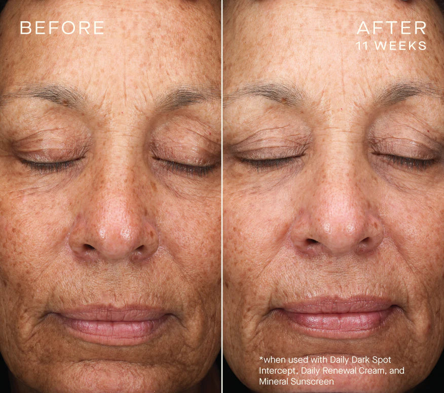 Ourself Daily Dark Spot Intercept Serums & Treatments Ourself