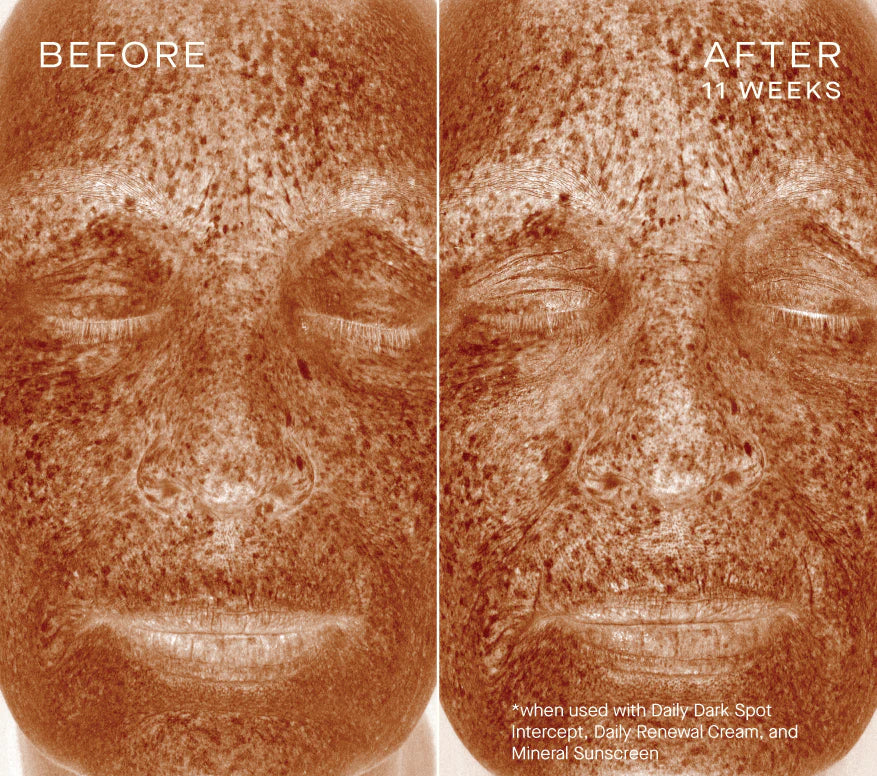 Ourself Daily Dark Spot Intercept Serums & Treatments Ourself