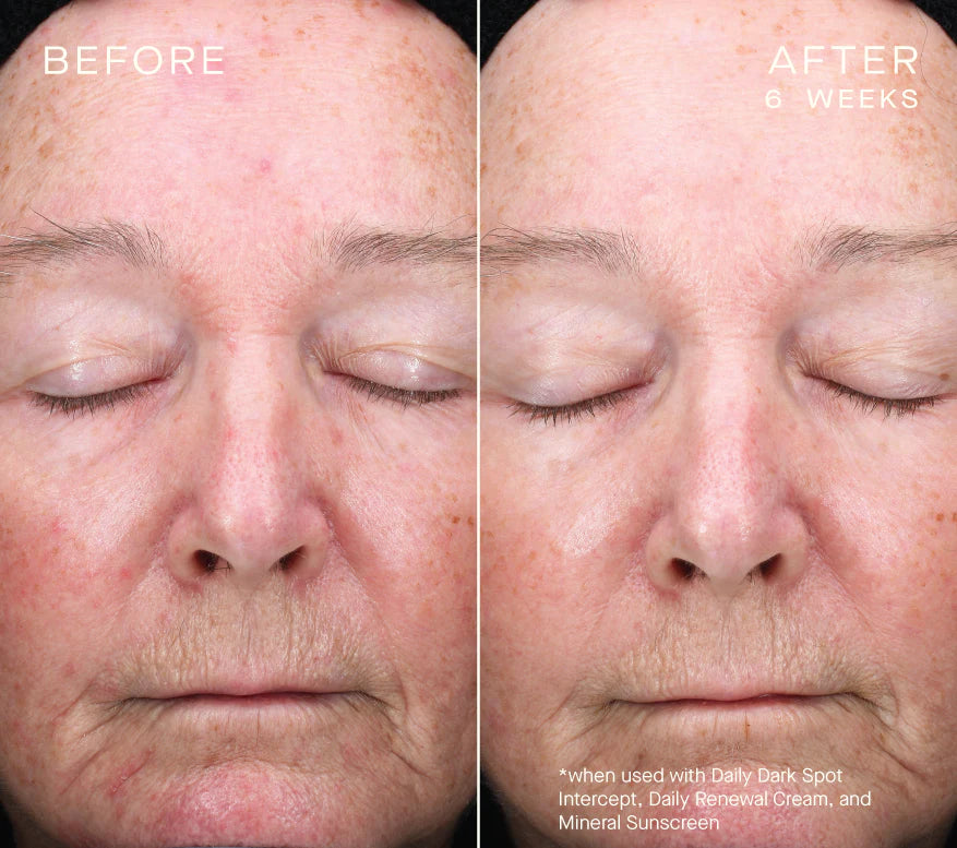 Ourself Daily Dark Spot Intercept Serums & Treatments Ourself