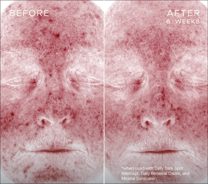 Ourself Daily Dark Spot Intercept Serums & Treatments Ourself