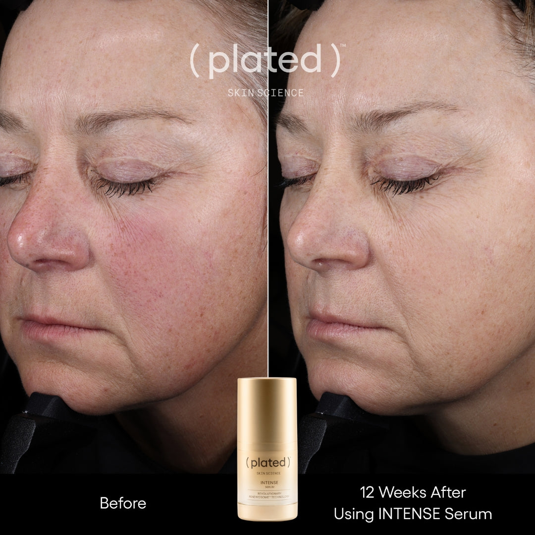 Plated Skin Science INTENSE Serum | Skin Truth