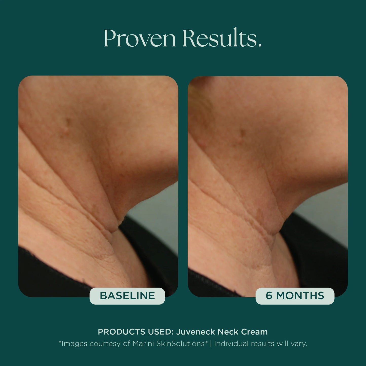 Marini Skin Solutions Juveneck Neck Cream