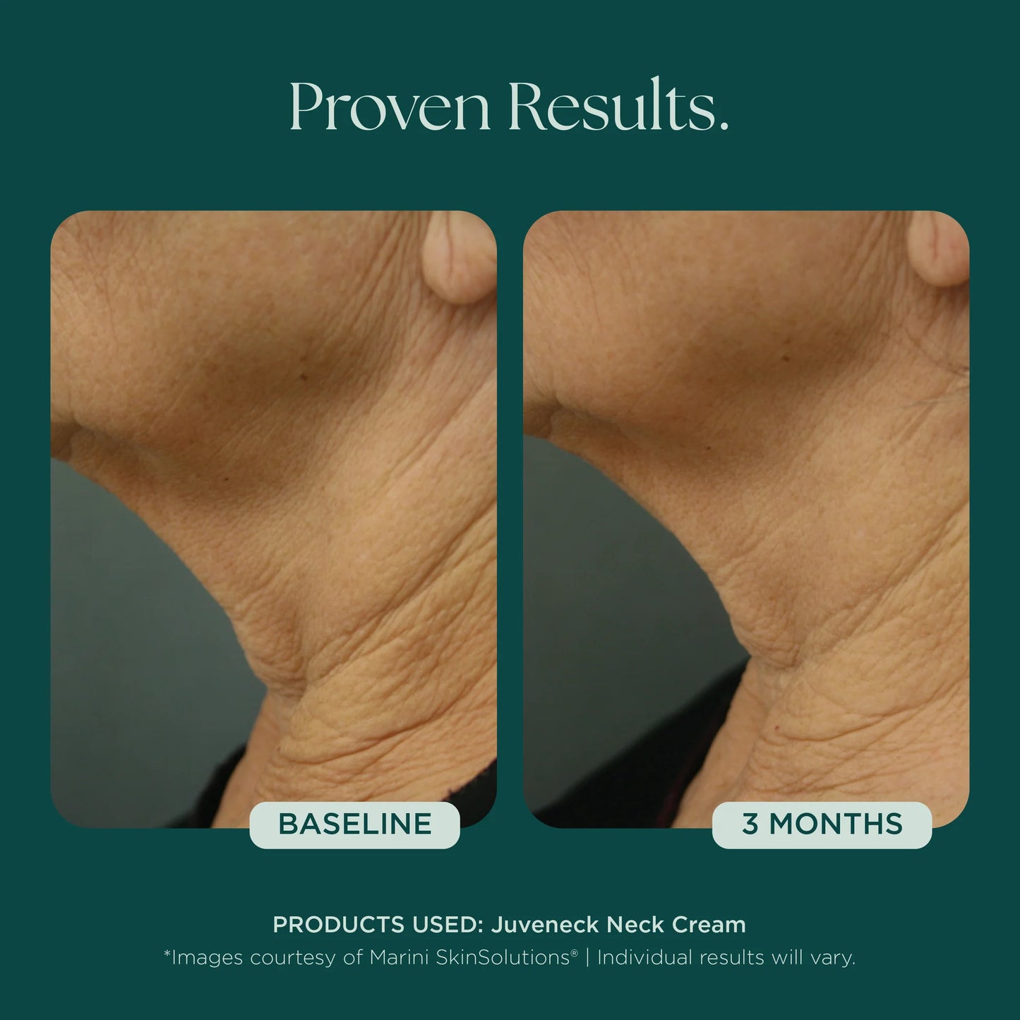 Marini Skin Solutions Juveneck Neck Cream