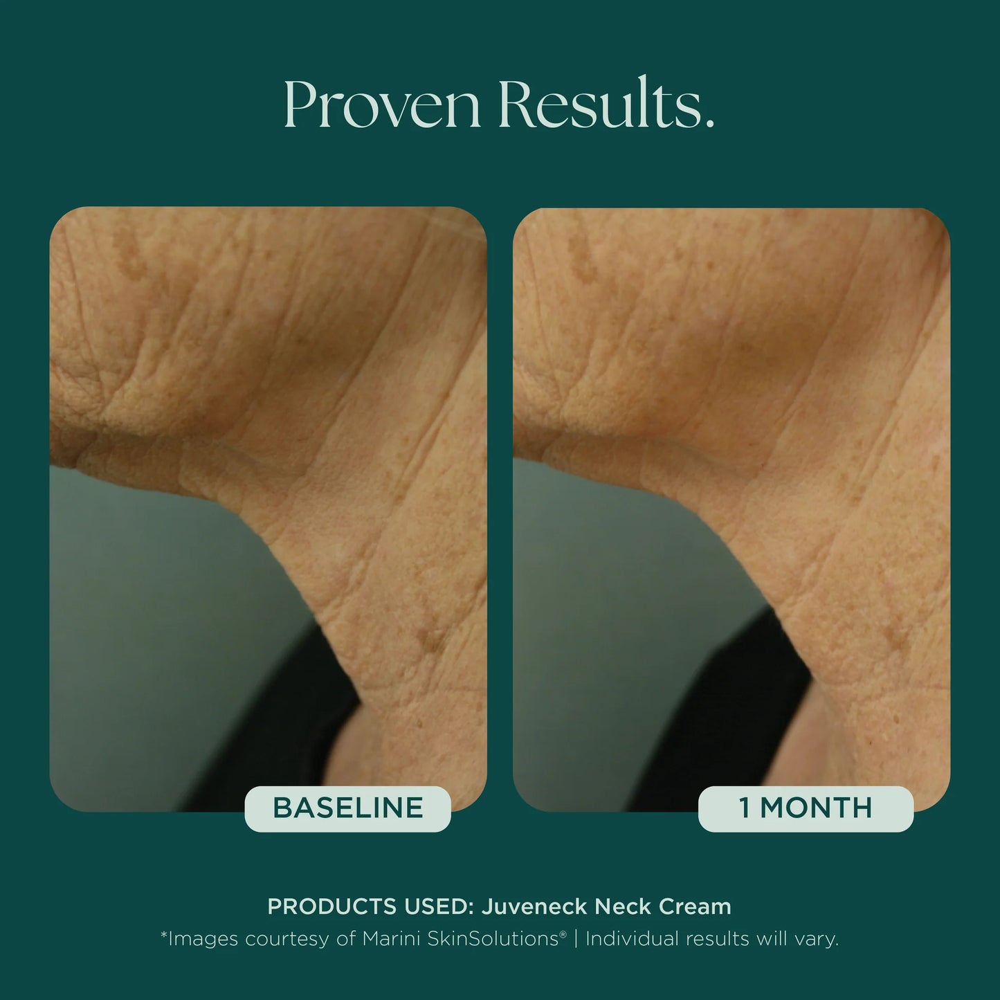 Marini Skin Solutions Juveneck Neck Cream