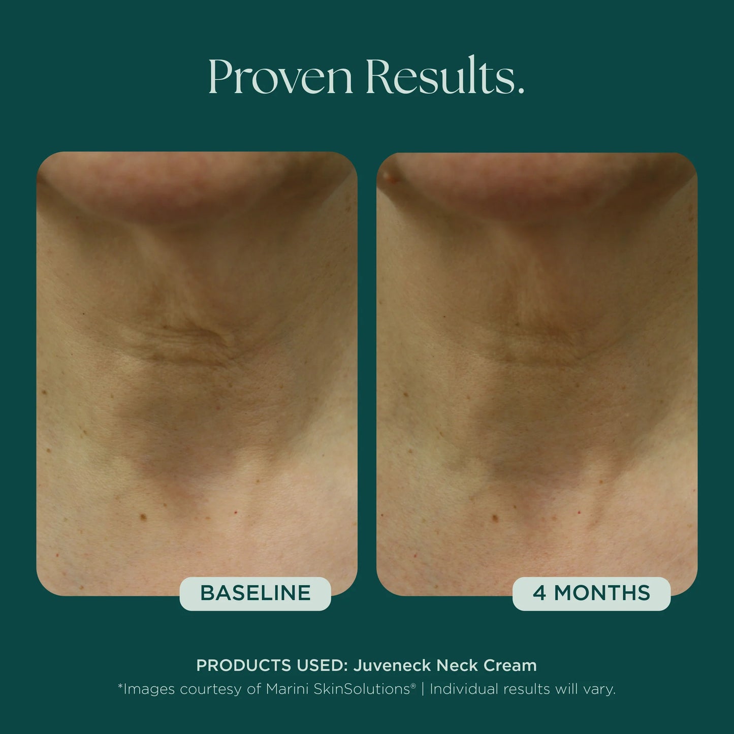 Marini Skin Solutions Juveneck Neck Cream