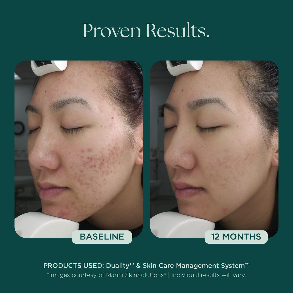 Marini SkinSolutions Duality