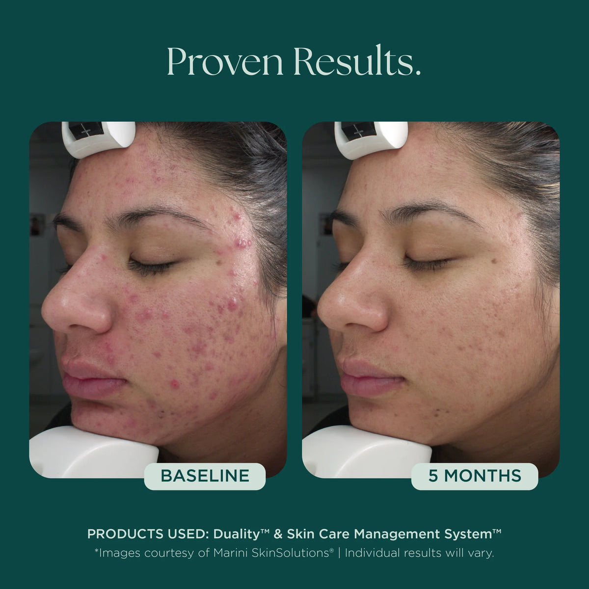 Marini SkinSolutions Duality