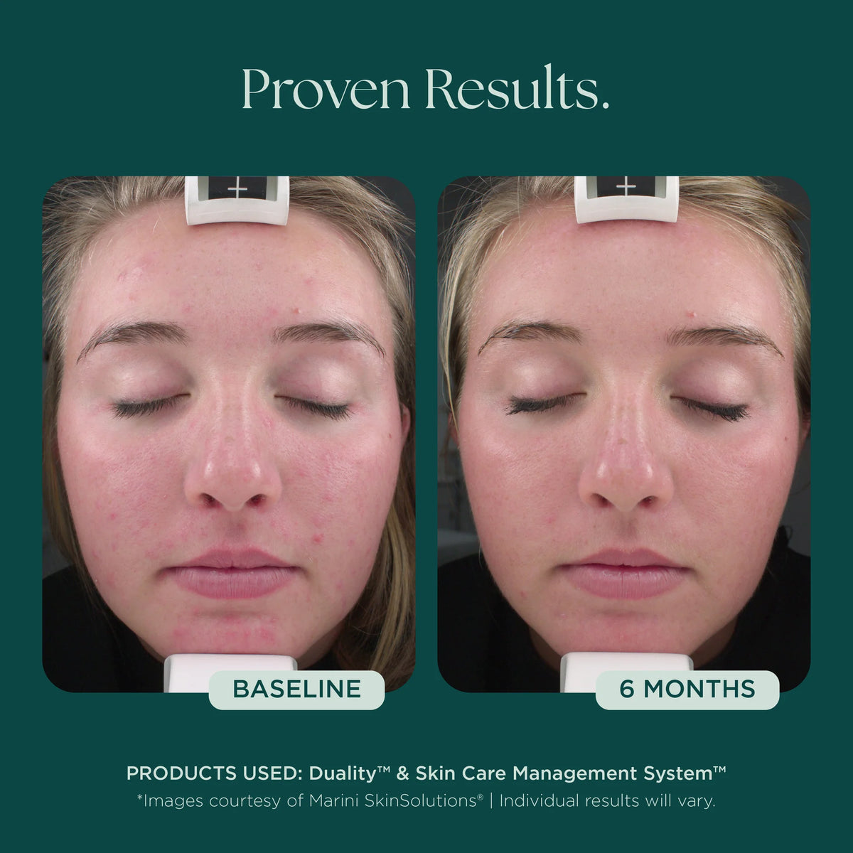 Marini SkinSolutions Duality