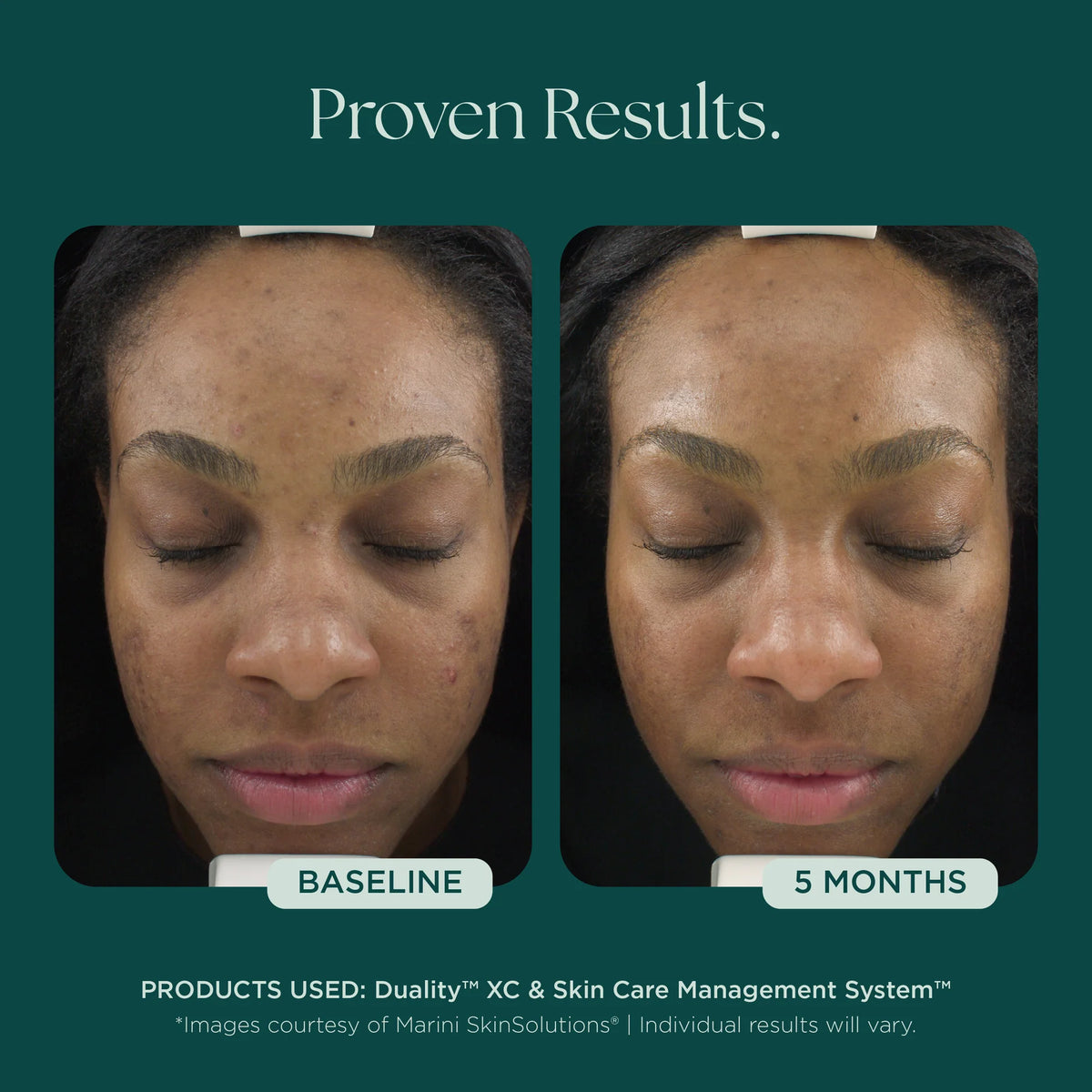 Marini SkinSolutions Duality
