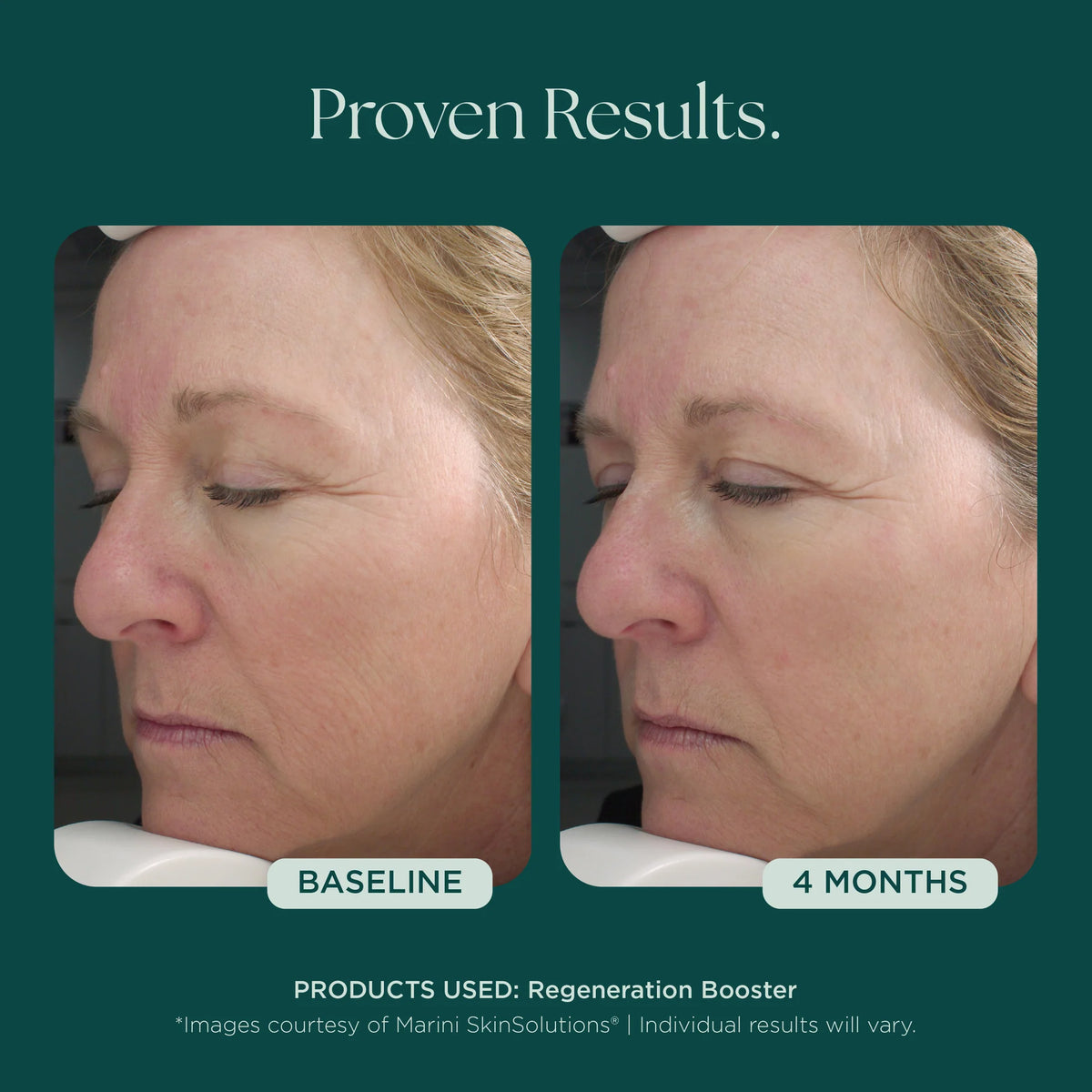 Marini SkinSolutions Regeneration Booster