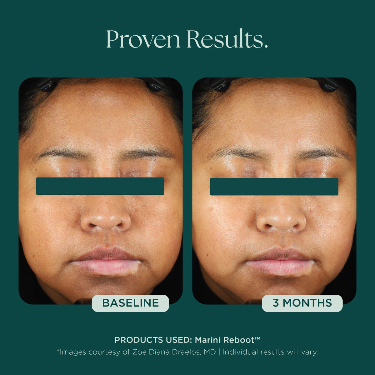 Marini SkinSolutions Reboot PDRN Face Serum