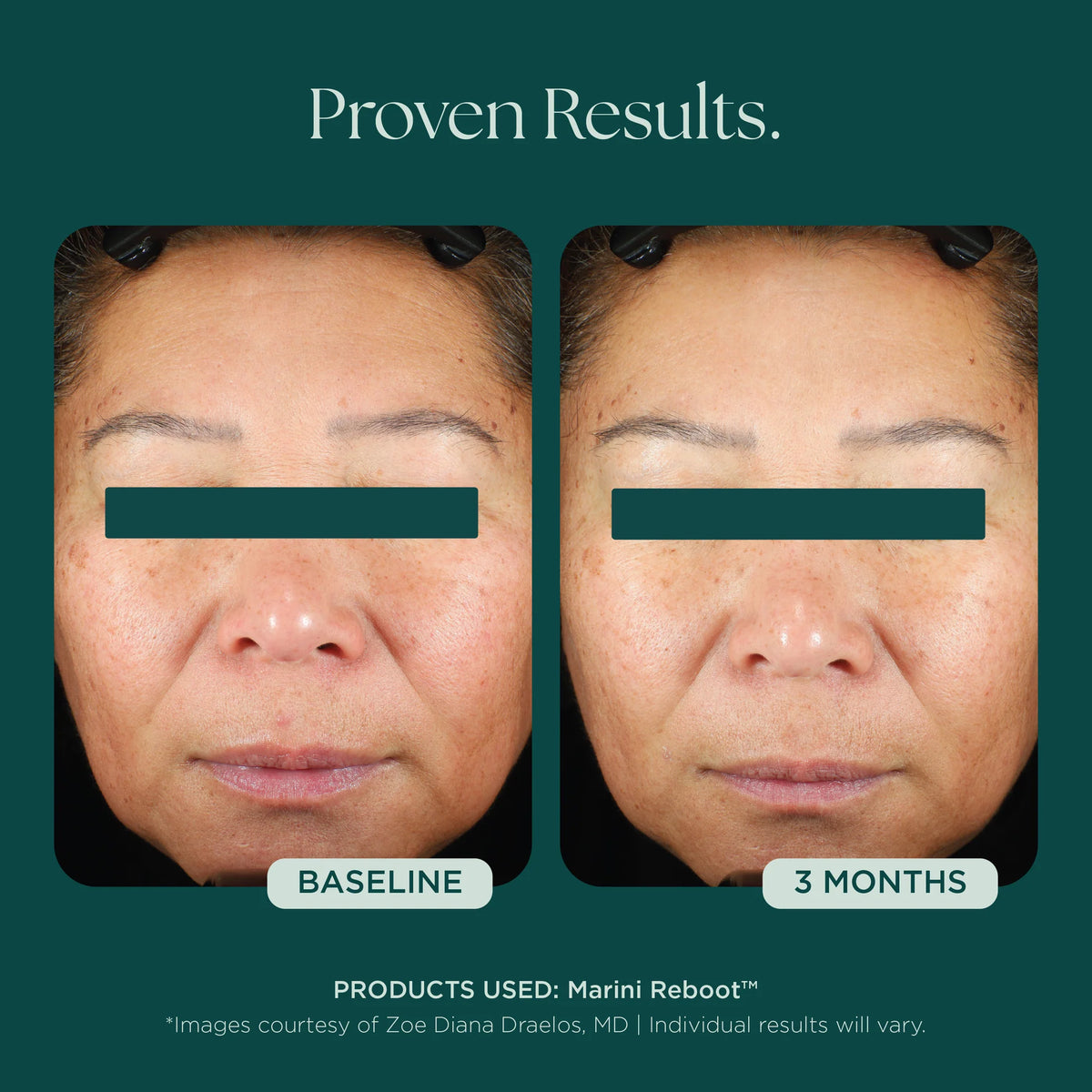Marini SkinSolutions Reboot PDRN Face Serum