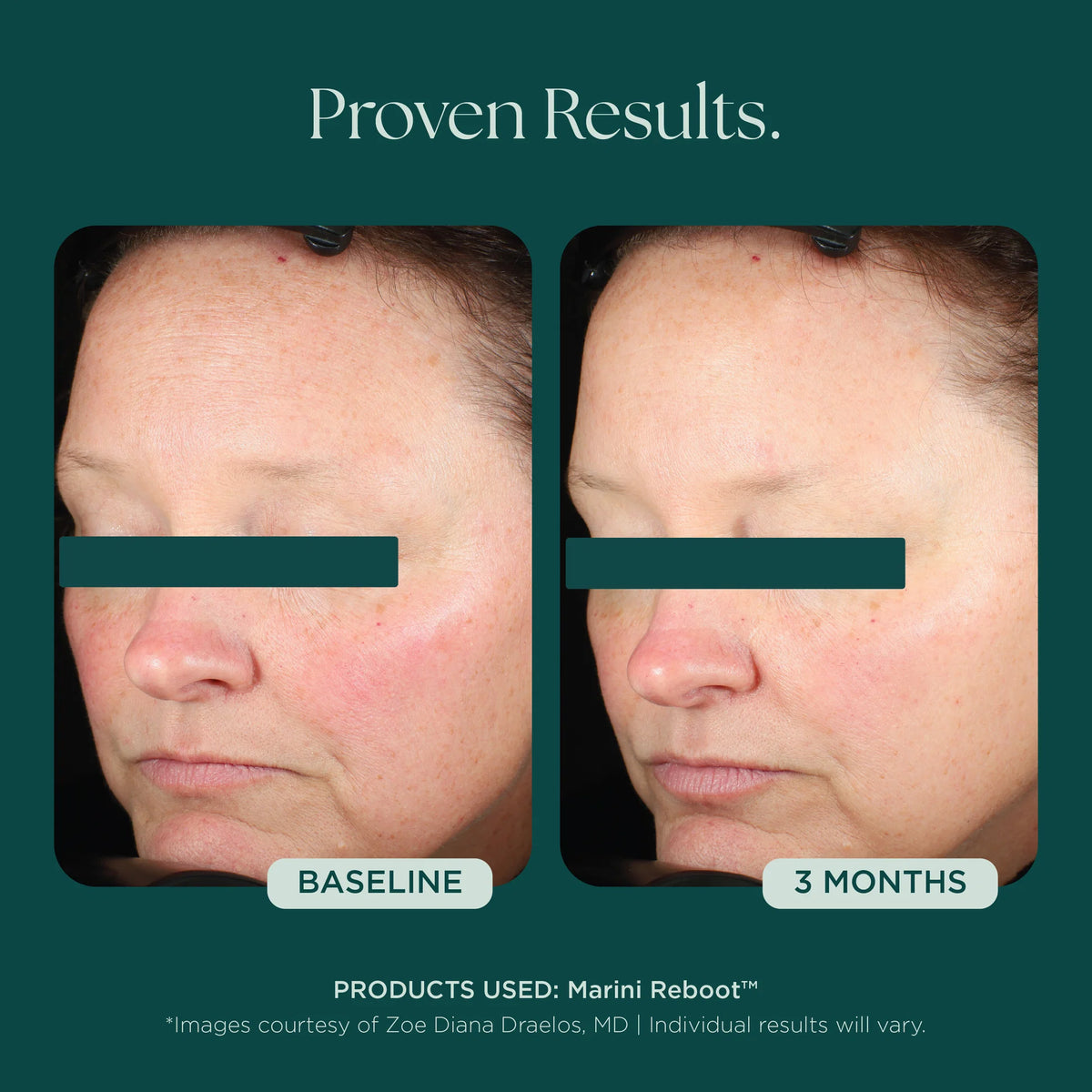 Marini SkinSolutions Reboot PDRN Face Serum