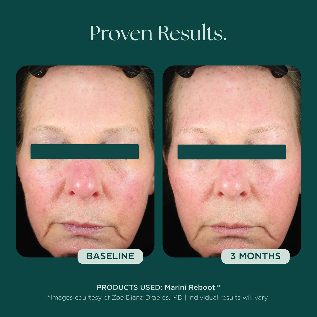 Marini SkinSolutions Reboot PDRN Face Serum
