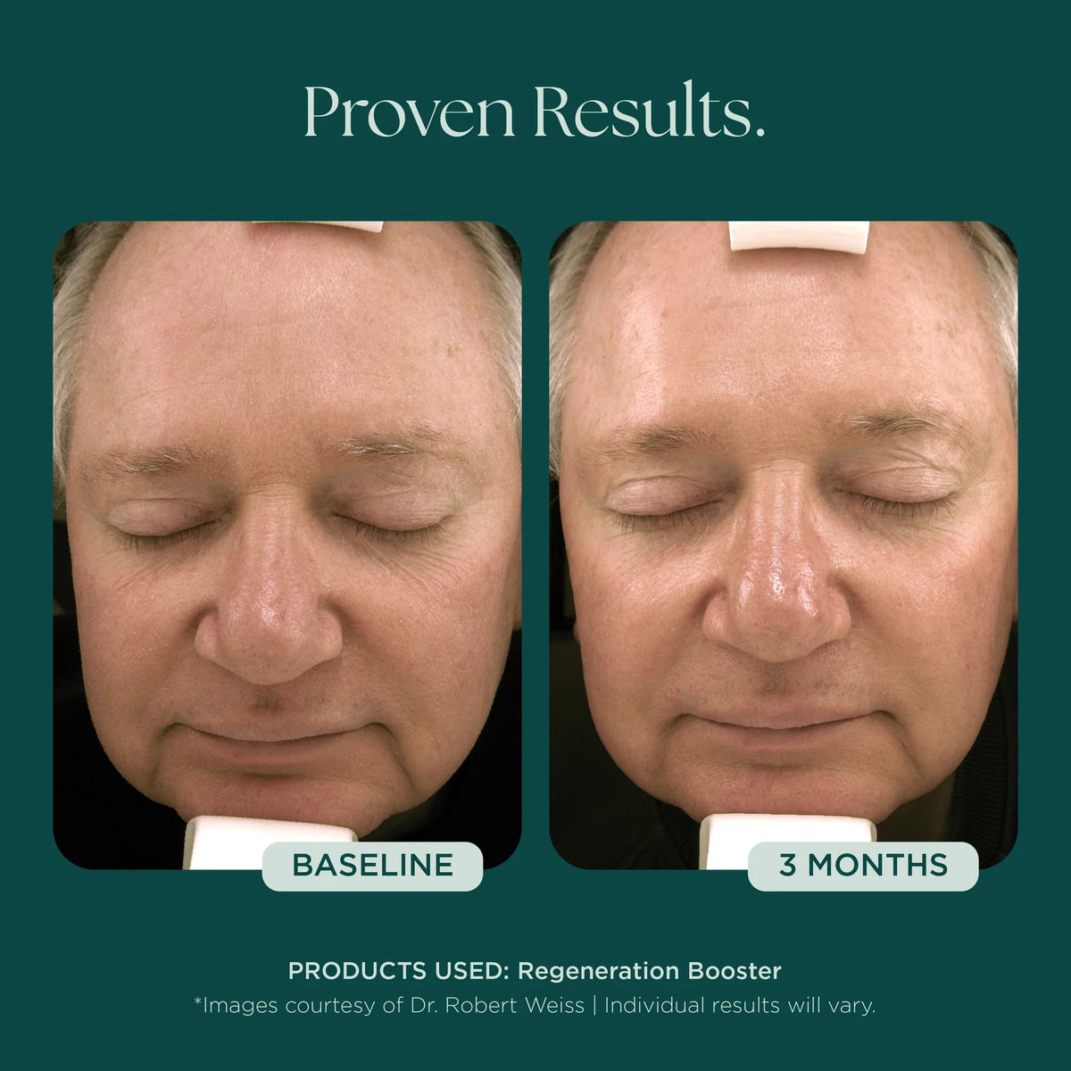 Marini SkinSolutions Regeneration Booster