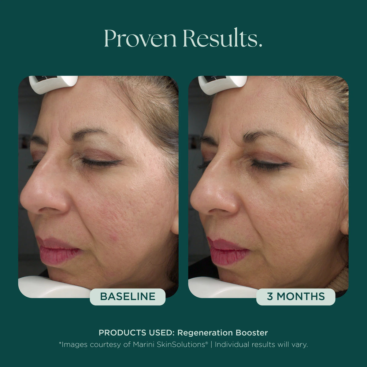 Marini SkinSolutions Regeneration Booster