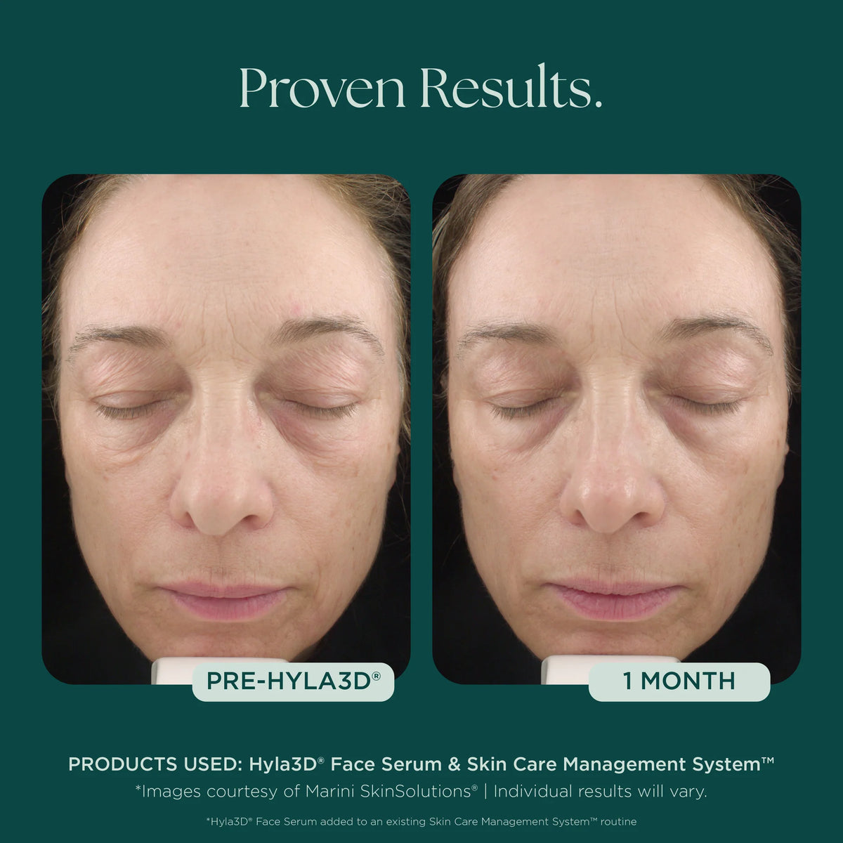 Marini SkinSolutions Hyla3D® Face Serum