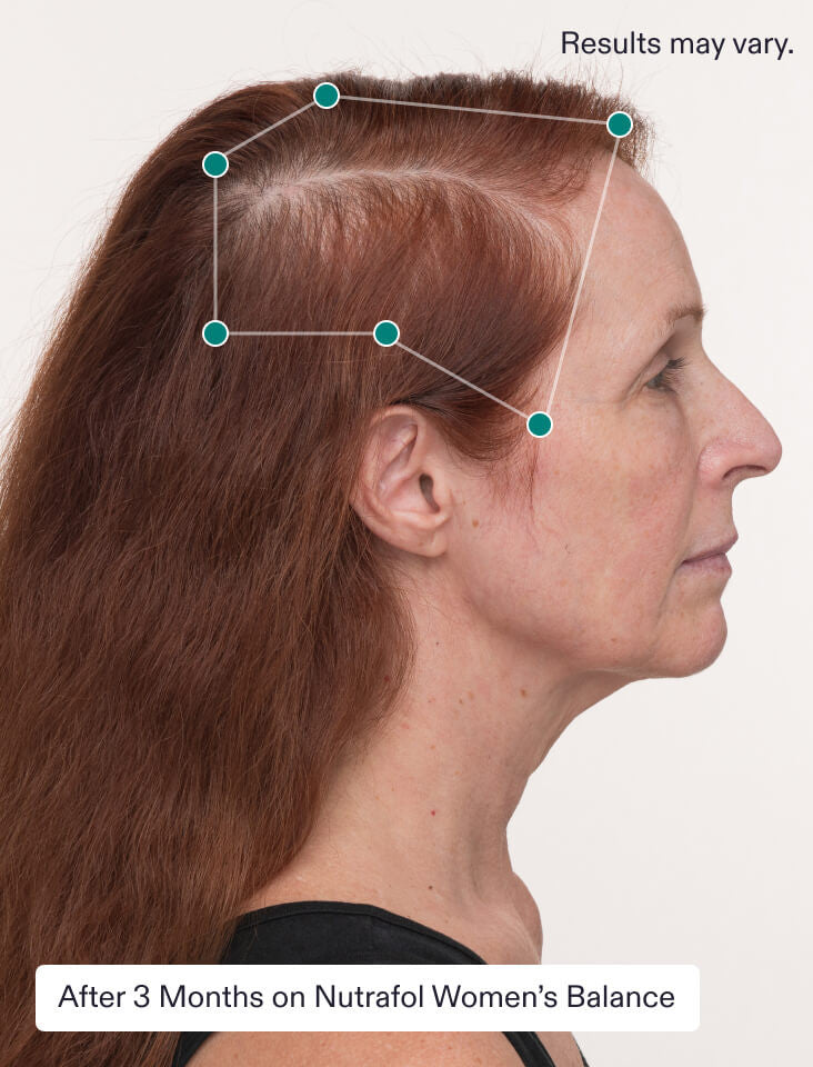 Nutrafol Hairbiotic Hair Growth Treatments & Supplements Nutrafol